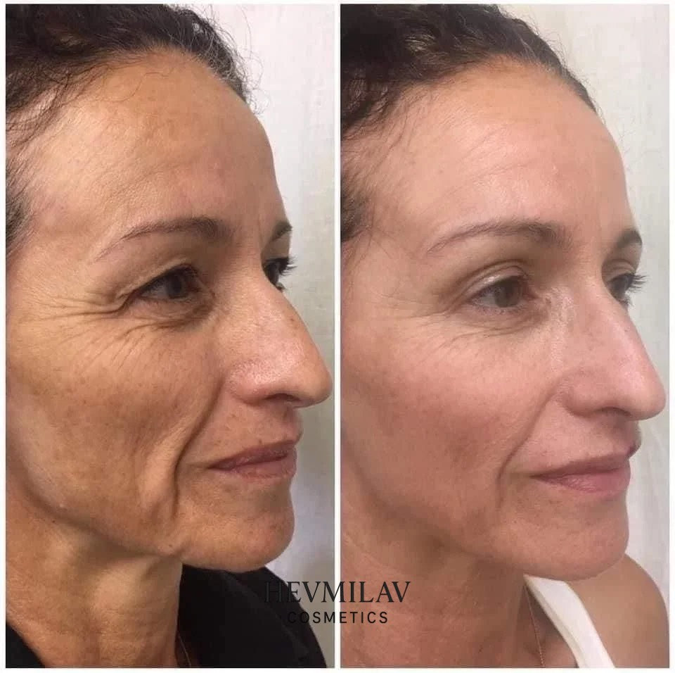 APPAREIL FACE LIFT LED | SÉRUM 24K GOLD